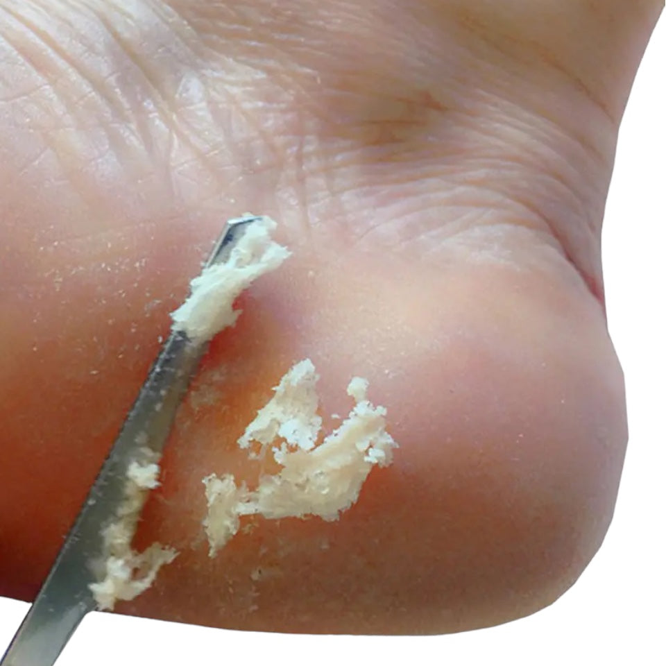 Stainless Steel Heel Scraper