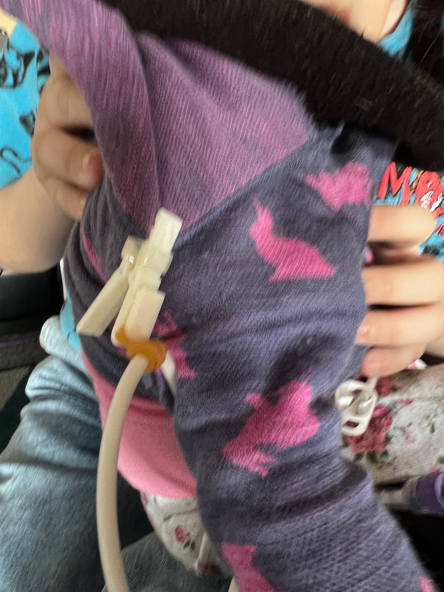 Medical Tubing Fixation Clamp Medical SPIRIT SPARKPLUGS