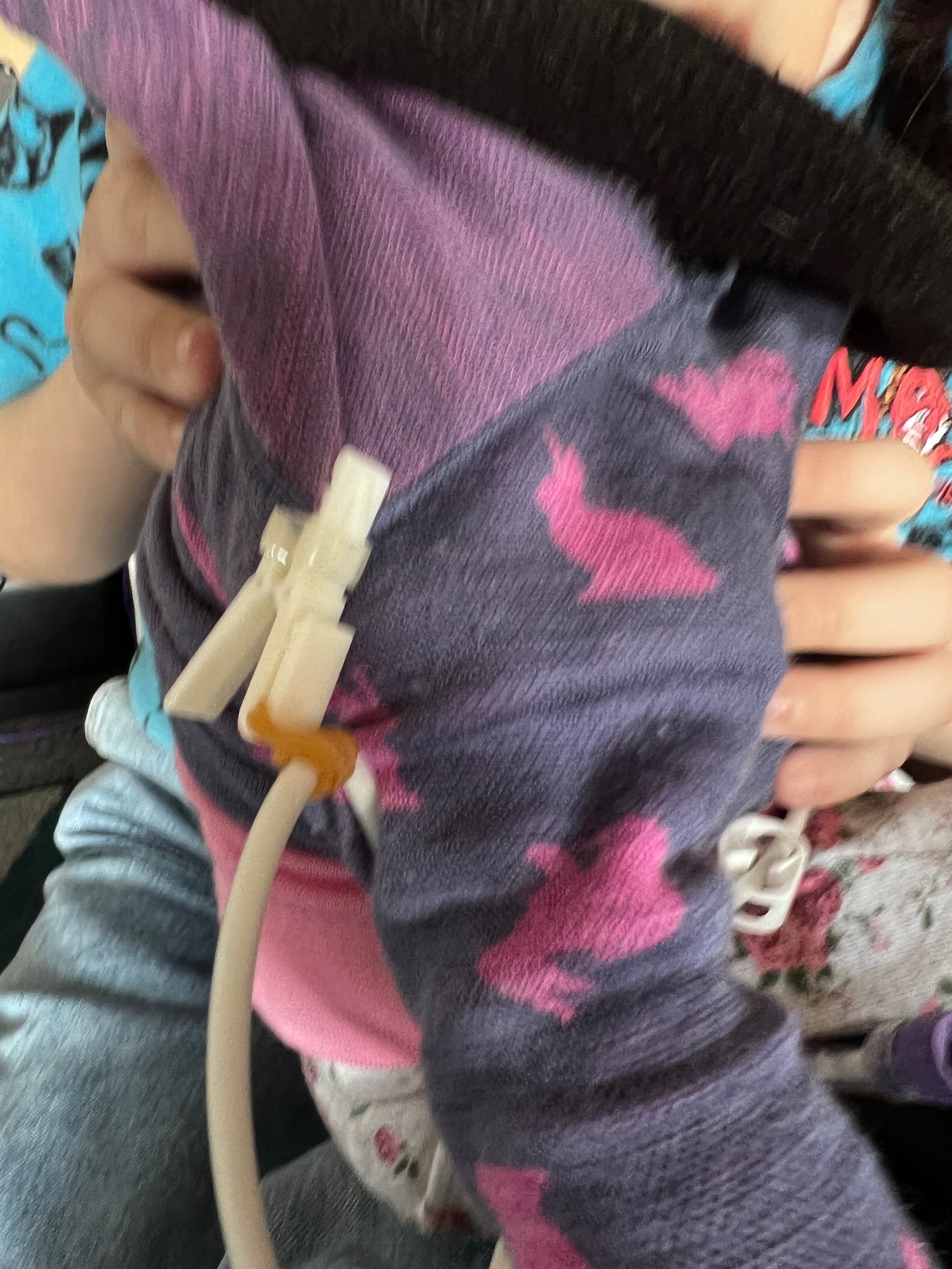 Medical Tubing Fixation Clamp Medical SPIRIT SPARKPLUGS