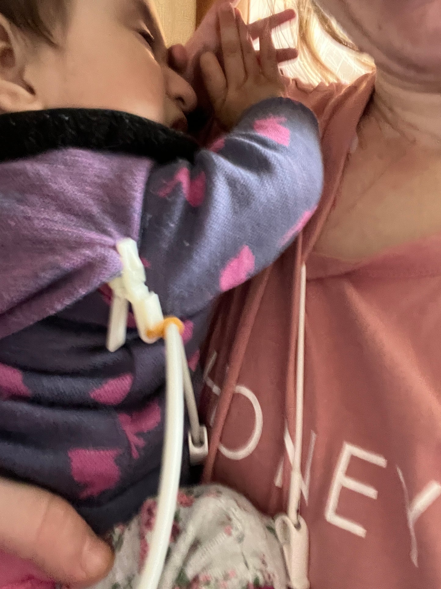 Medical Tubing Fixation Clamp Medical SPIRIT SPARKPLUGS