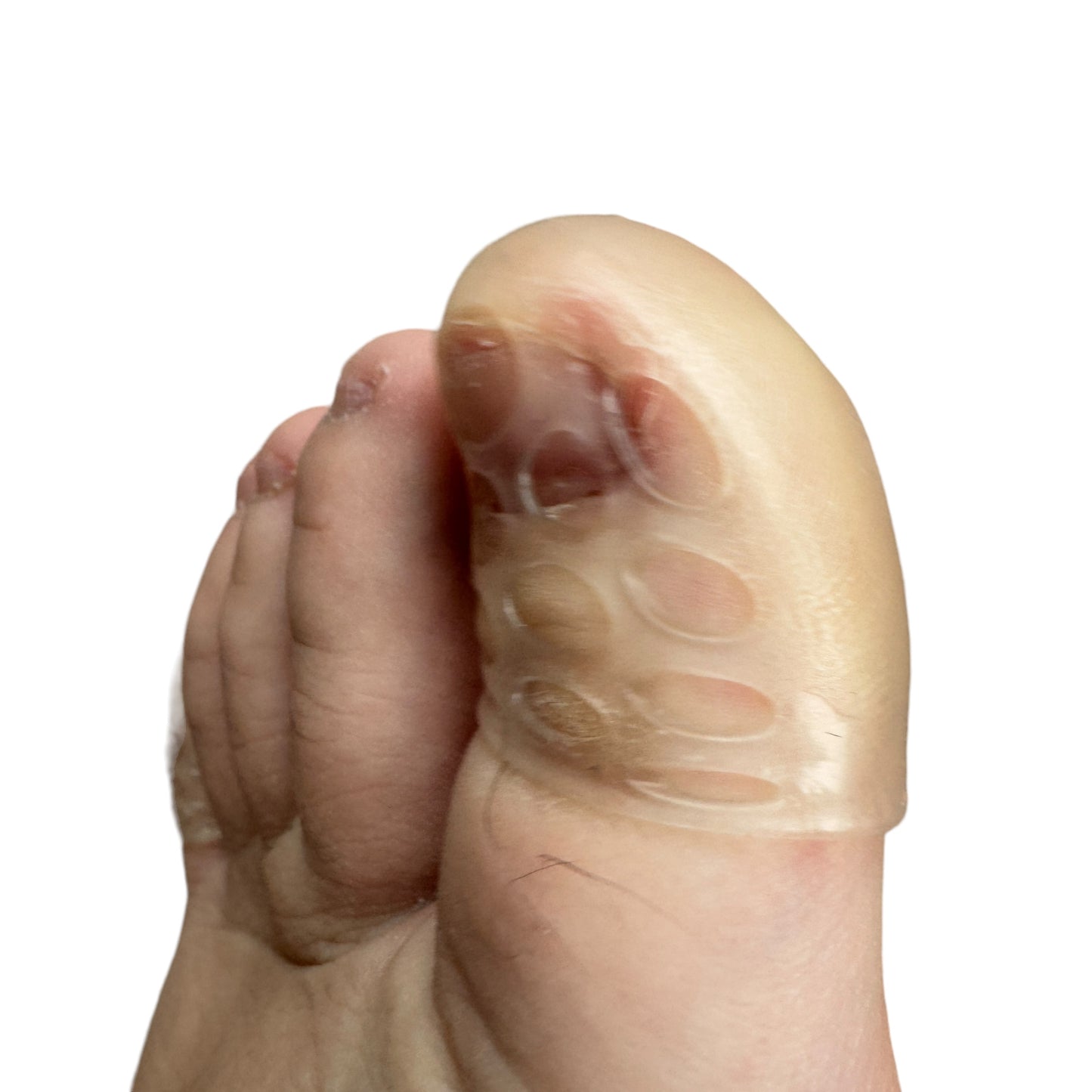 Silicone Toe or Finger Protector